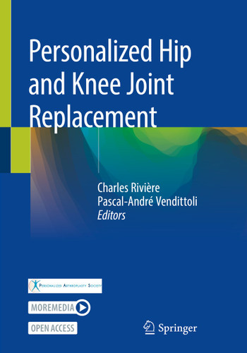 Personalized Hip and Knee Joint Replacement book cover by 