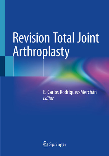 Revision Total Joint Arthroplasty book cover by 
