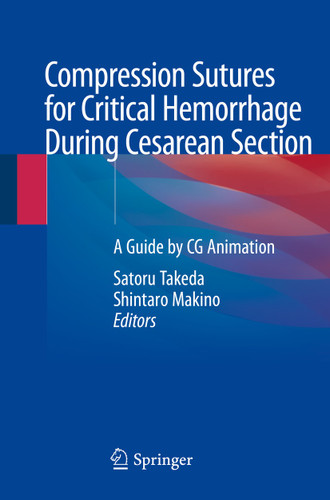 Compression Sutures for Critical Hemorrhage During Cesarean Section: A Guide by CG Animation book cover by 