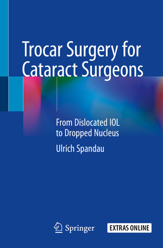 Trocar Surgery for Cataract Surgeons: From Dislocated IOL to Dropped Nucleus book cover by Ulrich Spandau