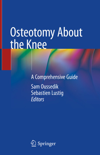 Osteotomy About the Knee: A Comprehensive Guide book cover by 