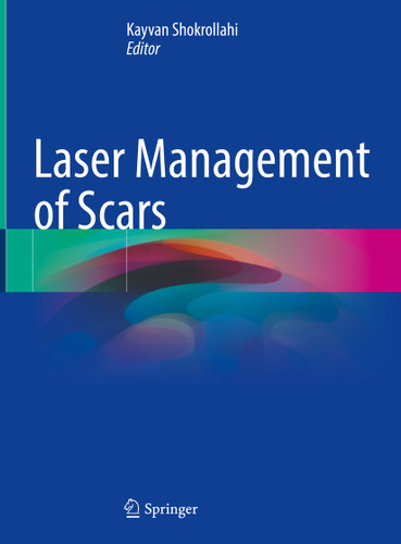 Laser Management of Scars book cover by 
