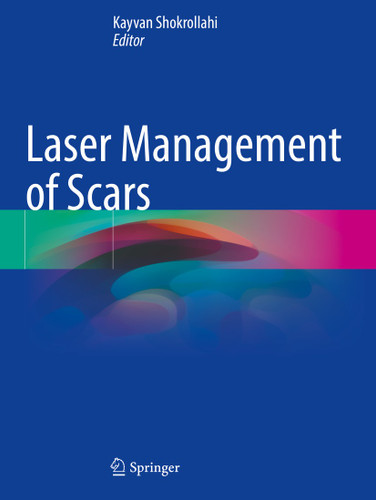 Laser Management of Scars book cover by 