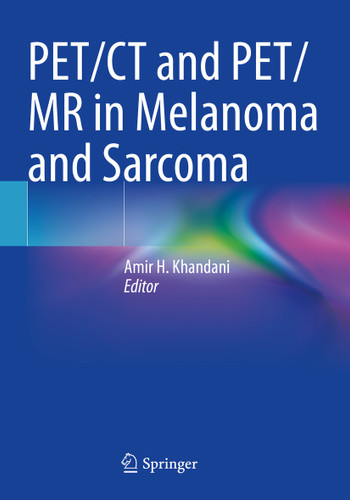 PET/CT and PET/MR in Melanoma and Sarcoma book cover by 