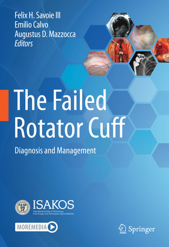 The Failed Rotator Cuff: Diagnosis and Management book cover by 