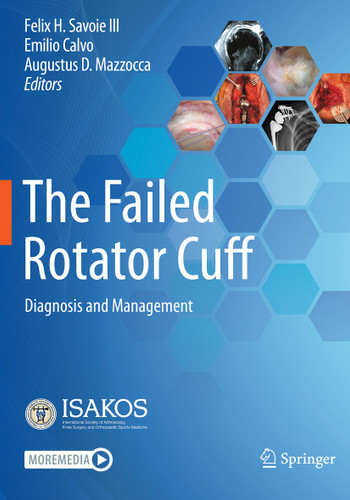 The Failed Rotator Cuff: Diagnosis and Management book cover by 