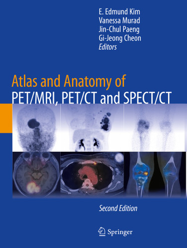 Atlas and Anatomy of PET/MRI, PET/CT and SPECT/CT book cover by 