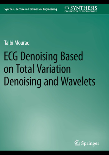 ECG Denoising Based on Total Variation Denoising and Wavelets (Synthesis Lectures on Biomedical Engineering) book cover by Talbi Mourad