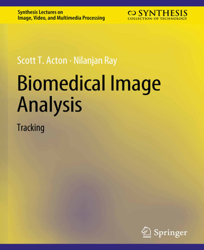 Biomedical Image Analysis: Tracking (Synthesis Lectures on Image, Video, and Multimedia Processing) book cover by Scott T. Acton, Nilanjan Ray