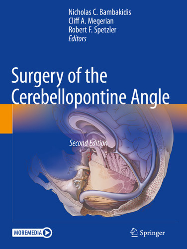 Surgery of the Cerebellopontine Angle book cover by 