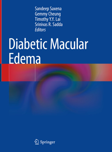 Diabetic Macular Edema book cover by 