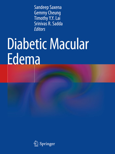 Diabetic Macular Edema book cover by 