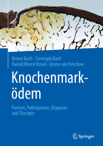 Knochenmarködem: Formen, Pathogenese, Diagnose und Therapie book cover by Reiner Bartl, Christoph Bartl, Harald Marcel Bonél, Emmo von Tresckow