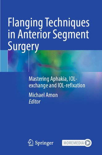 Flanging Techniques in Anterior Segment Surgery: Mastering Aphakia, IOL-exchange and IOL-refixation book cover by 