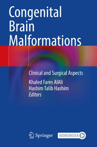 Congenital Brain Malformations: Clinical and Surgical Aspects book cover by 
