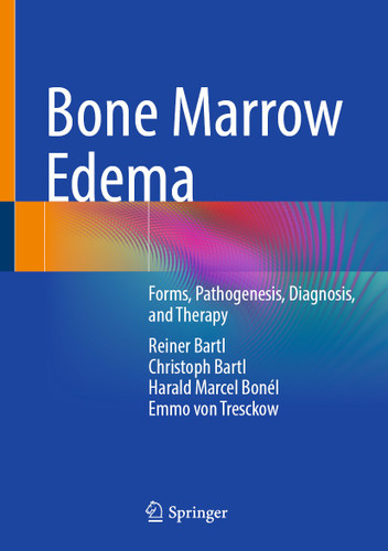Bone Marrow Edema: Forms, Pathogenesis, Diagnosis, and Therapy book cover by Reiner Bartl, Christoph Bartl, Harald Marcel Bonél, Emmo von Tresckow