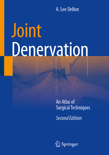 Joint Denervation: An Atlas of Surgical Techniques book cover by 