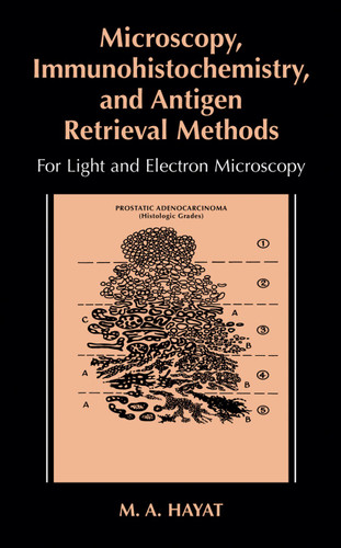 Microscopy, Immunohistochemistry, and Antigen Retrieval Methods: For Light and Electron Microscopy book cover by M.A. Hayat