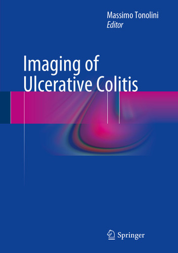 Imaging of Ulcerative Colitis book cover by 