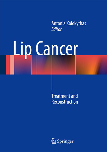 Lip Cancer: Treatment and Reconstruction book cover by 