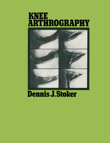 Knee Arthrography book cover by Dennis J. Stoker