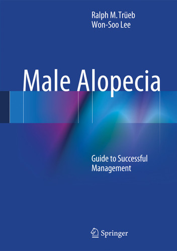 Male Alopecia: Guide to Successful Management book cover by Ralph M. Trüeb, Won-Soo Lee
