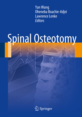Spinal Osteotomy book cover by 