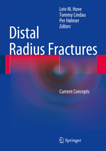 Distal Radius Fractures: Current Concepts book cover by 