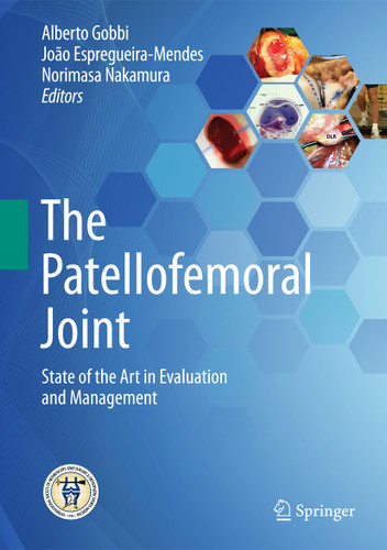 The Patellofemoral Joint: State of the Art in Evaluation and Management book cover by 