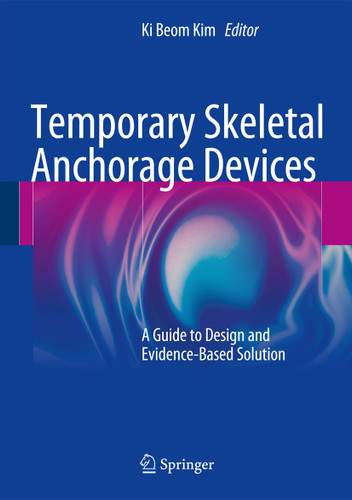 Temporary Skeletal Anchorage Devices: A Guide to Design and Evidence-Based Solution book cover by 