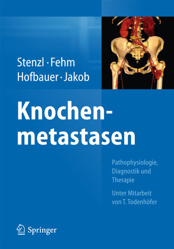 Knochenmetastasen: Pathophysiologie, Diagnostik und Therapie - Unter Mitarbeit von T. Todenhöfer book cover by 