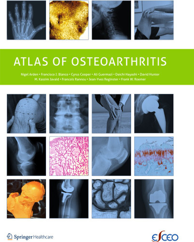Atlas of Osteoarthritis book cover by Nigel Arden, Francisco Blanco, C. Cooper, Ali Guermazi, Daichi Hayashi, David Hunter, M. Kassim Javaid, Francois Rannou, Frank Roemer, Jean-Yves Reginster