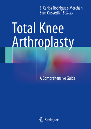 Total Knee Arthroplasty: A Comprehensive Guide book cover by 