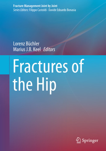 Fractures of the Hip (Fracture Management Joint by Joint) book cover by 