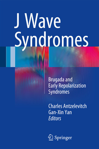 J Wave Syndromes: Brugada and Early Repolarization Syndromes book cover by 