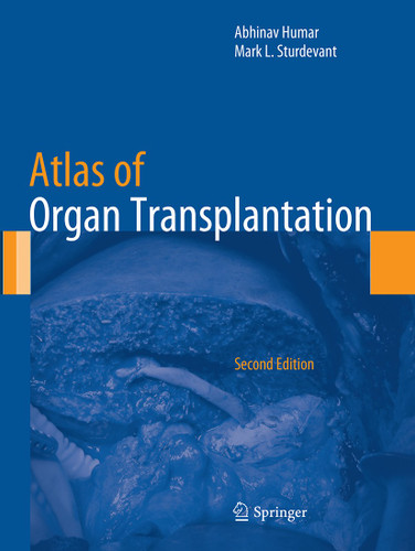 Atlas of Organ Transplantation book cover by 