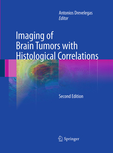Imaging of Brain Tumors with Histological Correlations book cover by 