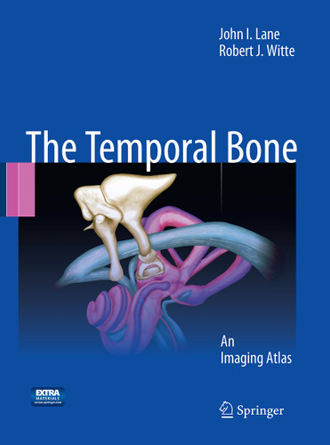 Temporal Bone: An Imaging Atlas book cover by John I. Lane, Robert J. Witte