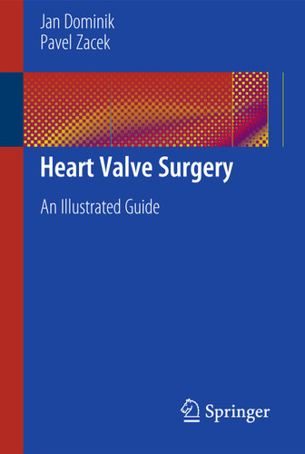 Heart Valve Surgery: An Illustrated Guide book cover by Jan Dominik, Pavel Zacek