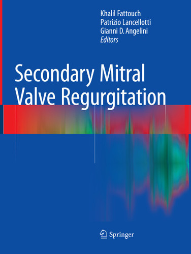Secondary Mitral Valve Regurgitation book cover by 