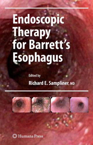 Endoscopic Therapy for Barrett's Esophagus (Clinical Gastroenterology) book cover by 