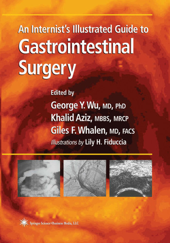 An Internist’s Illustrated Guide to Gastrointestinal Surgery (Clinical Gastroenterology) book cover by 