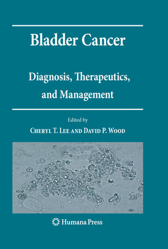 Bladder Cancer: Diagnosis, Therapeutics, and Management (Current Clinical Urology) book cover by 