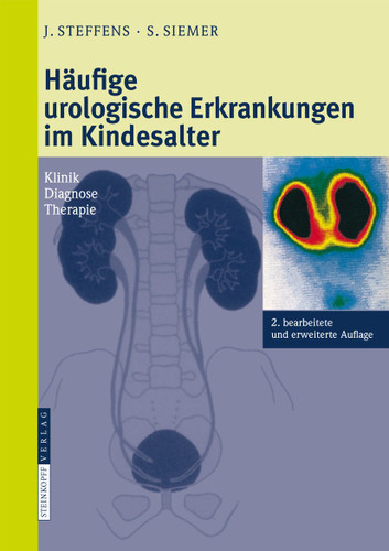 Häufige urologische Erkrankungen im Kindesalter: Klinik Diagnose Therapie book cover by Joachim Steffens, Stefan Siemer