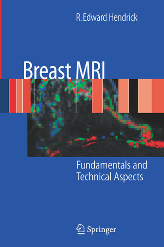 Breast MRI: Fundamentals and Technical Aspects book cover by R. Edward Hendrick