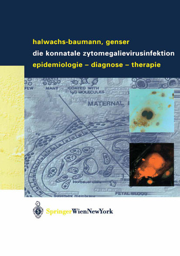 Die konnatale Zytomegalievirusinfektion: Epidemiologie - Diagnose - Therapie book cover by Gabriele Halwachs-Baumann, Bernd Genser