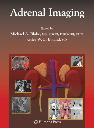 Adrenal Imaging (Contemporary Medical Imaging) book cover by 