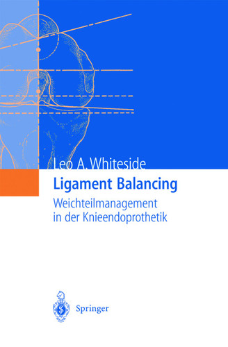 Ligament Balancing: Weichteilmanagement in der Knieendoprothetik book cover by Leo A. Whiteside