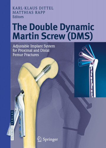 The Double Dynamic Martin Screw (DMS): Adjustable Implant System for Proximal and Distal Femur Fractures book cover by 