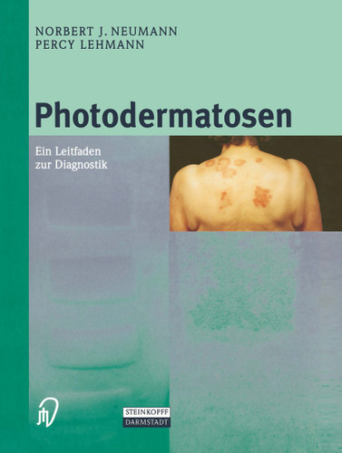 Photodermatosen: Ein Leitfaden zur Diagnostik book cover by N.J. Neumann, Percy Lehmann